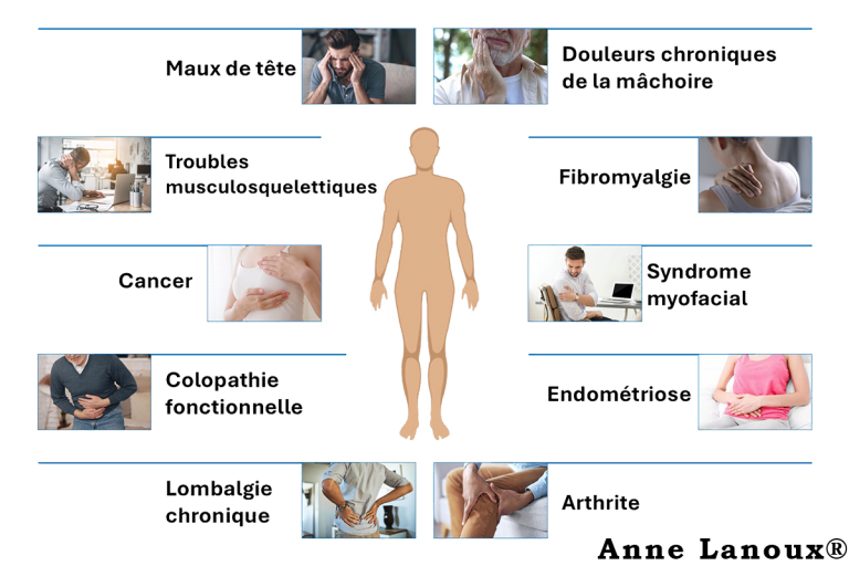 Douleur Chronique et Ostéopathie