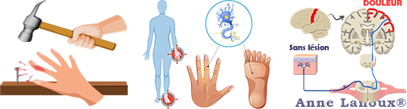 Caractéristiques de la douleur